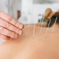 Uncovering the Benefits of Acupuncture for Fibromyalgia Pain Relief