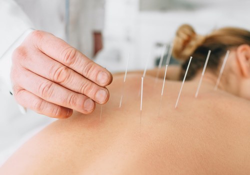 Uncovering the Benefits of Acupuncture for Fibromyalgia Pain Relief